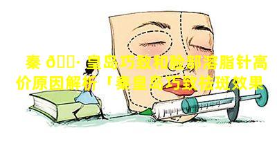 秦 🌷 皇岛巧致和脸部溶脂针高价原因解析「秦皇岛巧致祛斑效果好不好」